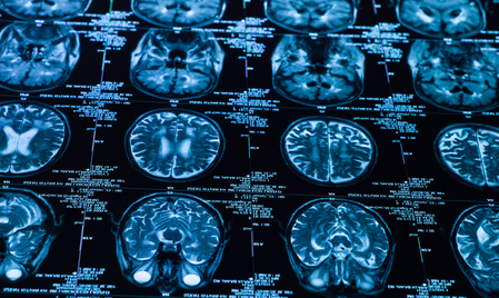 sharp ct scan of the human brain