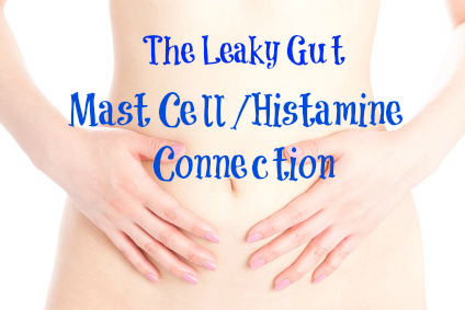 picture of woman's stomach leaky gut mast cells histamine